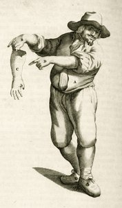 Rimozione della pelle morta con pustole, da Exercitationes Practicae circa Medendi Methodum di Frederik Dekkers, 1694 da Dutch School