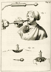 Uso di una siringa per somministrare un purgante, da Exercitationes Practicae circa Medendi Methodum di Frederik Dekkers, 1694 da Dutch School