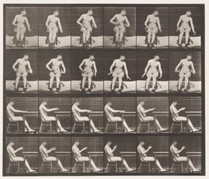 Tavola 545. Convulsioni Indotte Artificialmente; A, B, Mentre si è seduti