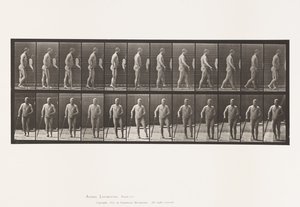 Tavola 552. Emiplegia; camminare con un bastone, 1885