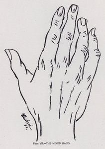 La mano mista