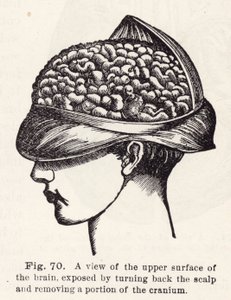 Vista della superficie superiore del cervello, esposta sollevando il cuoio capelluto e rimuovendo una parte del cranio (incisione) da English School
