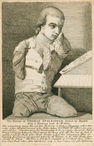 Thomas Inglefield, nato il 18 dicembre 1769 a Hook, Hampshire, senza braccia né gambe da English School