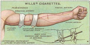 Laccio emostatico, n.11 dalla serie di carte di sigarette di primo soccorso di Willss, 1913 da English School