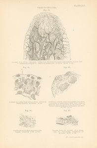 Villi nel colera (litografia a colori)