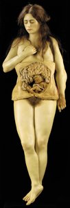 Modello Anatomico di una Gravidanza Ovarica