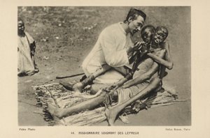Missionario che cura i lebbrosi da French Photographer