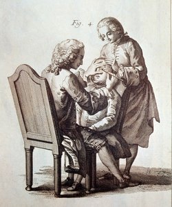 Un dottore che opera un paziente con cataratta, illustrazione dall