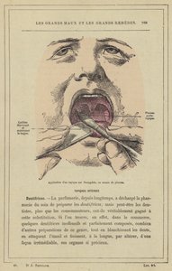 Applicazione di un topico sull