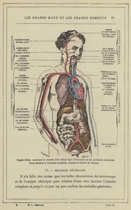 Figura ideale, che mostra il percorso di un virus nell