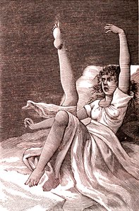 Isteria, un fenomeno mentale estremo, psicosi e psiconeurosi. 1887