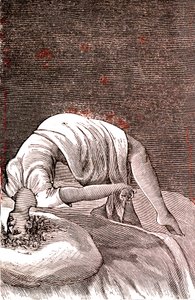 Isteria, disturbo mentale e nervoso, derivante da intensa ansia. 1887 da French School