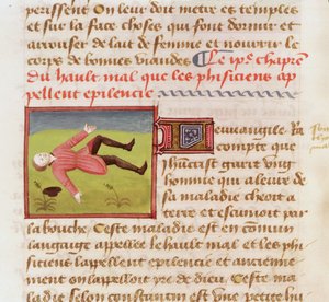 Ms 22532 Paziente che soffre di un attacco epilettico, da Le Livre des Proprietes des choses di Barthelemy l