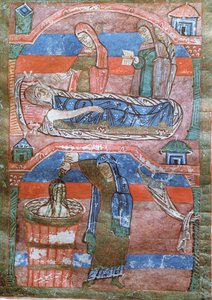 Ms 250 Donna idropica curata dai bagni di St. Radegund, da La Vita di St. Radegund da French School