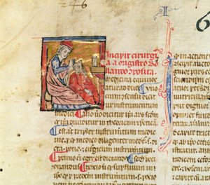 Ms Lat. 7134 fol.1 Trapanazione, da Chirugie de Maitre Rolandi da French School