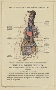Organi della produzione e della circolazione del sangue in una donna clorotica (litografia a colori) da French School
