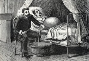 Paziente con cirrosi epatica avanzata, medico che esegue una puntura (incisione) 1888 da French School