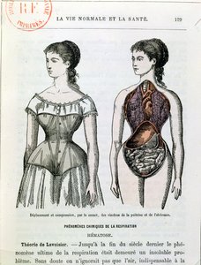 Gli effetti dannosi del corsetto, illustrazione da La Vie Normale et la Sante di Dr Jules Rengade (n.1841) c.1880 da French School