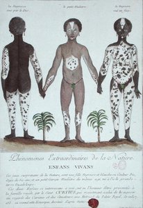 Il fenomeno della leucoderma da French School