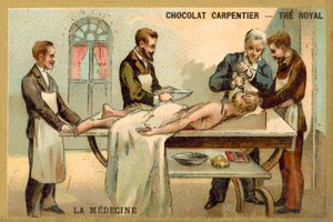 Trapanazione da French School