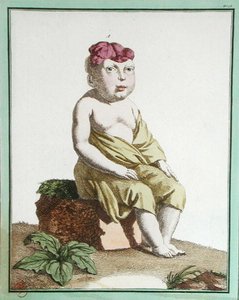 Bambino con metà testa, da 