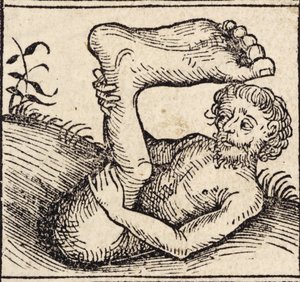Un sciopode, Uomo con un piede gonfio, da 