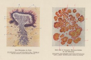 Actinomyces bovis