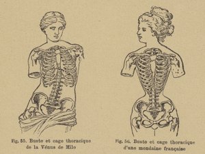 Confronto della forma del petto e della gabbia toracica della Venere di Milo con quella di una socialite francese di fine XIX secolo da German School