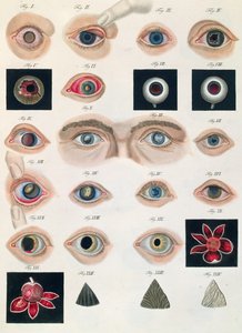 Descrizione delle anomalie congenite dell