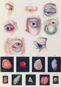 Descrizione delle anomalie congenite dell