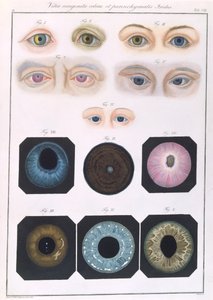 Descrizione delle anomalie congenite dell