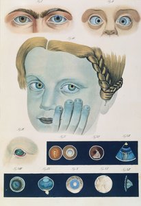 Descrizione delle anomalie congenite dell