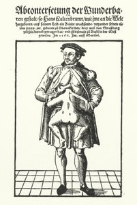 Hans Kaltenbrunn e il suo gemello congiunto non sviluppato da German School