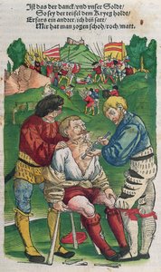 Rimozione di una freccia, illustrazione da Feldtbuch der Wundartzney di Hans von Gersdorff, 1540 da German School