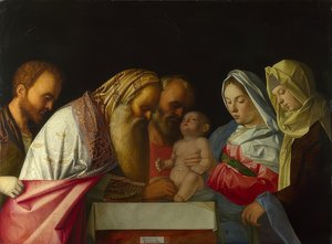 La circoncisione di Gesù