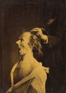 Stupore, sbalordimento, meraviglia