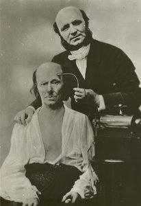 Il neurologo francese Duchenne de Boulogne utilizza il suo apparato di elettrofisiologia su un anziano da Guillaume Benjamin Armand Duchenne de Boulogne