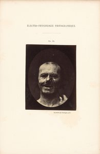 Elettrofisiologia fotografica, Figura 53