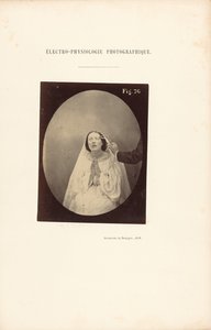 Elettrofisiologia fotografica, Figura 76