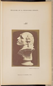Fig. 66 da Guillaume Benjamin Duchenne