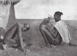 Africa: Stregone che sanguina un paziente da Hugo Adolf Bernatzik