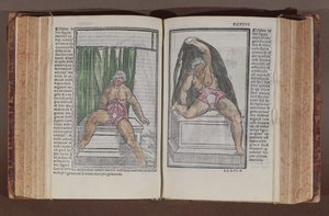 Anatomia femminile, da Commentaria cum amplissimis additionibus super anatomiam mundini, di Jacopo Berengario da Carpi (c.1460-c.1530) pubblicato a Bologna, 1521 (xilografia a colori)