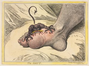 La gotta da James Gillray