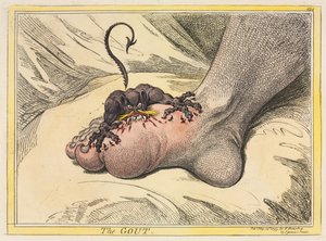 La gotta da James Gillray