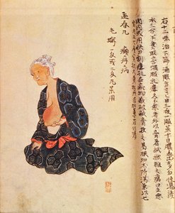Il primo trattamento chirurgico del cancro al seno eseguito sotto anestesia generale da Seishu Hanaoka (1760-1836) nel 1804 da Japanese School