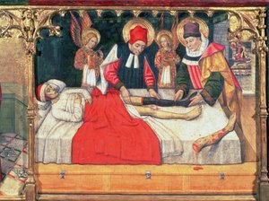 SS. Cosma e Damiano innestano la gamba di un uomo etiope sul moncone del diacono Giustiniano da Jaume Huguet