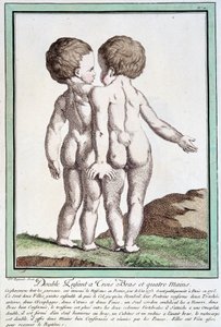 Bambini siamesi - in “Les deviations de la nature” di Régnault da Jean Baptiste Regnault