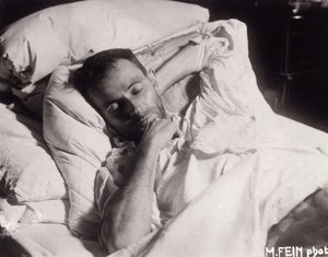 Egon Schiele sul letto di morte da Martha Fein
