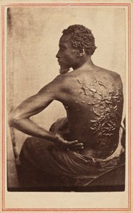 La schiena flagellata, c. 1863 (foto) da McPherson & Oliver