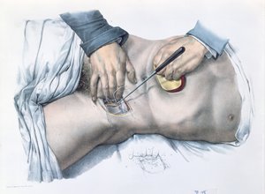 Legatura di un